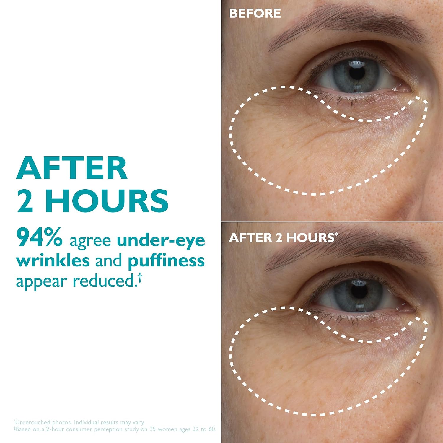 Peptide-Infused Skin Smoothers