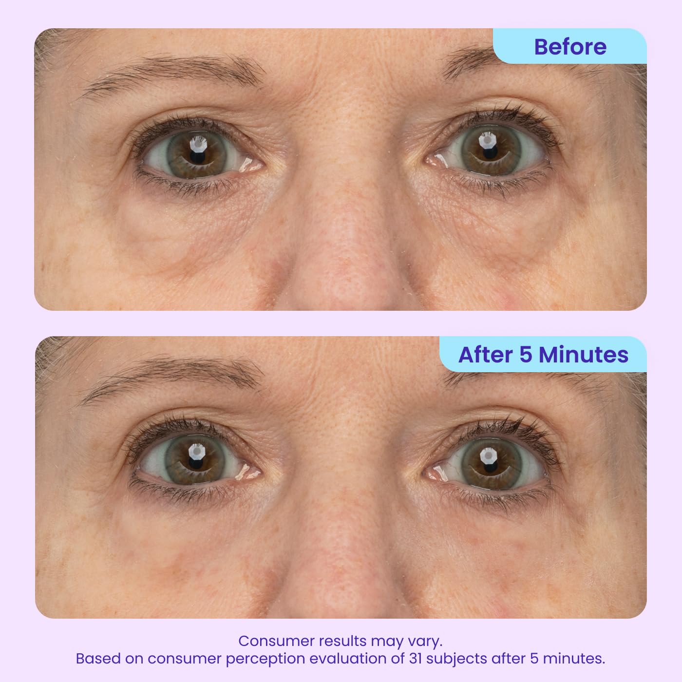 Instant Eye Lift Gel