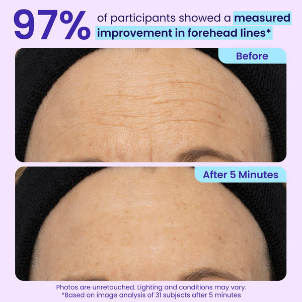 Instant Eye Lift Gel